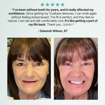 Ends Today: 70% OFF! QIAWI™? Custom-Fit Full Functional DenturesMake you more confident